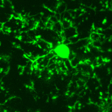 Figuur 6. Microgliacel in hersenweefsel van een transgene muis