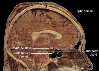 Figuur 15. Sella turcica en hypofyse, schematische weergave